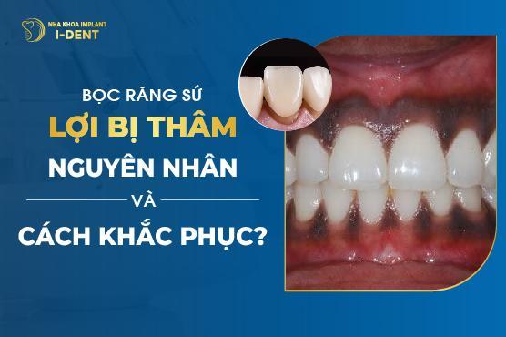 Hình ảnh thỏi vàng giả bị lộ lớp kim loại thường bên trong
