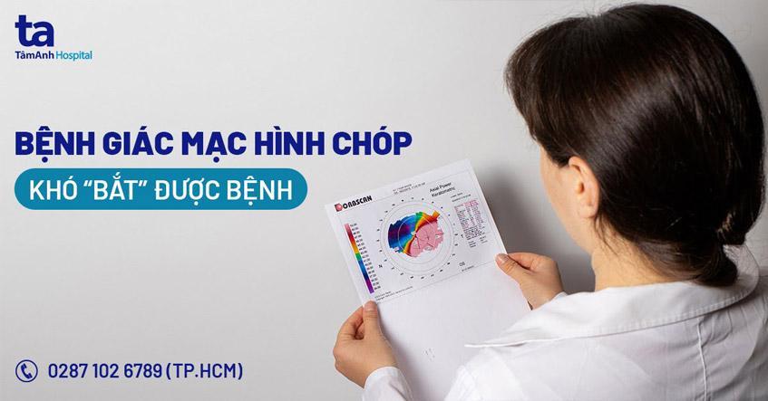 Hình chóp tứ giác với các yếu tố cấu thành